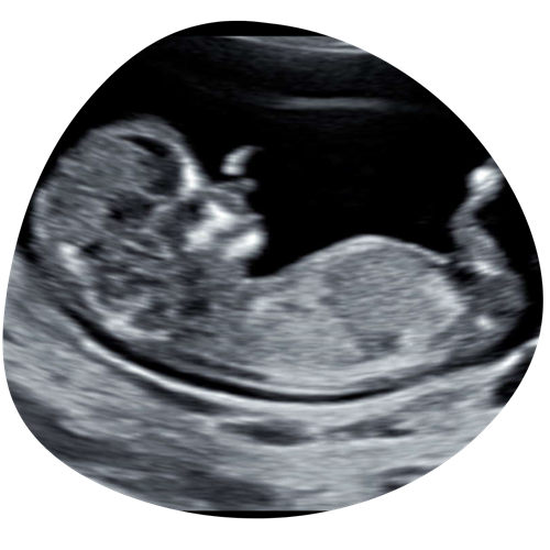 Ontwerp Zonder Titel 2