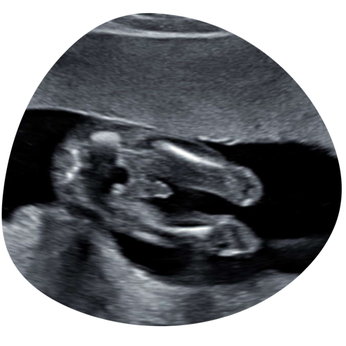 Ontwerp Zonder Titel 1